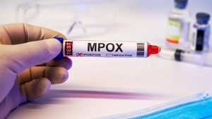 Govt steps into action as Pakistan’s first mpox patient goes missing